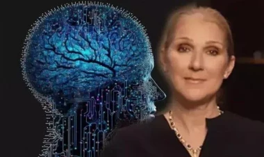 Selin Dionun tutulduğu nadir sindrom – Əlamətləri nələrdir?