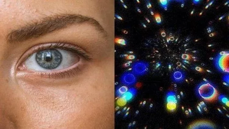 Göz önündə qəribə naxışlarının yaranmasının səbəbi məlum oldu