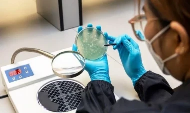 Ölümcül bakteriyalarla bağlı XƏBƏRDARLIQ: insanı 48 saatda öldürür