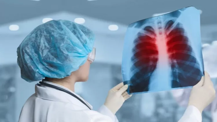 Vərəmin qarşısının alınmasında yeni era: İnnovativ peyvəndin sınaq tarixi AÇIQLANDI