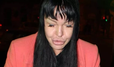 “Elit star” Cəmilə TANINMAZ HALDA - FOTO