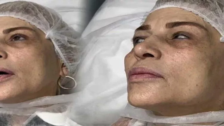 Mətanət İsgəndərli tanınmaz hala düşdü – FOTO