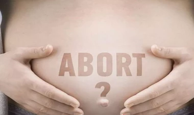 Selektiv abortlara şərait yaradılır? - Ekspertlərdən AÇIQLAMA