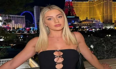 Stomatoloq idi: Hazırda 10 dəqiqəyə min dollar qazanır - FOTOlar