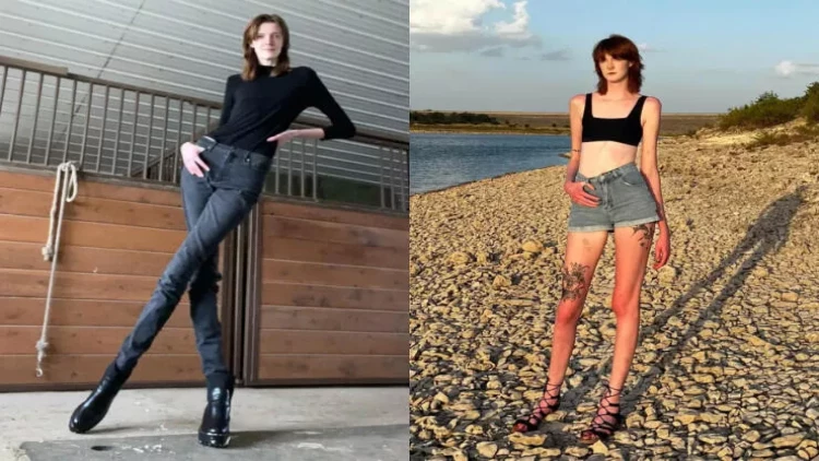 Dünyanın ən uzun ayaqlı qadını: Həyatının çətinliklərindən DANIŞDI - FOTOlar