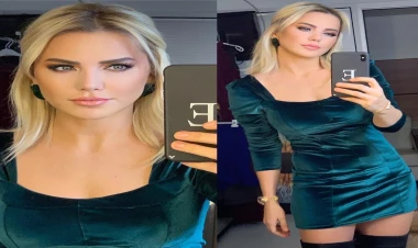 Məşhur aparıcı tanınmaz halda - VİDEO