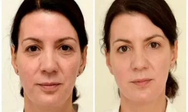 8 stəkan su nələri dəyişə bilər?