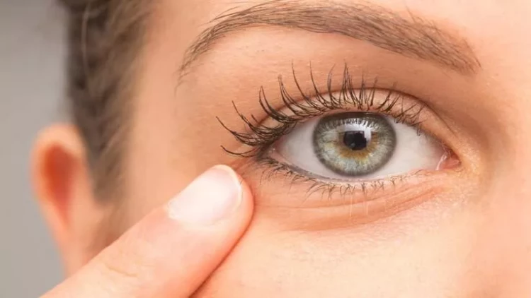 Gözaltı torbalardan xilas olmaq üçün bunları edin