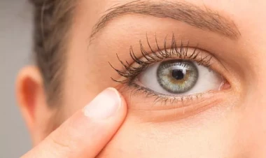 Gözaltı torbalardan xilas olmaq üçün bunları edin