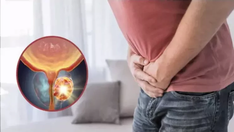 Kişilərin diqqətinə, bu xərçəng növü sürətlə artır