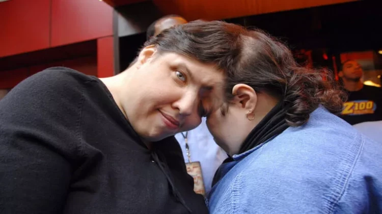 Dünyanın ən yaşlı siam əkizləri vəfat ediblər