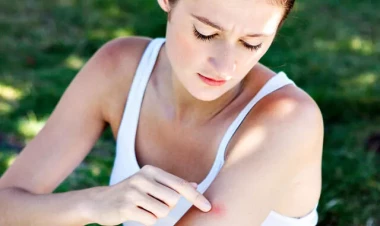 Ağcaqanadların qarşısını almaq üçün bağçada  bunu əkin