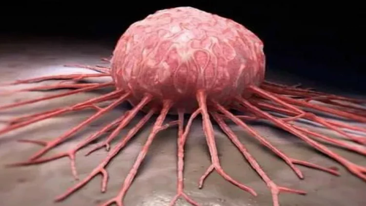 Səhərlər bu 3 əlamət onkologiyanı göstərə bilir - DİQQƏT