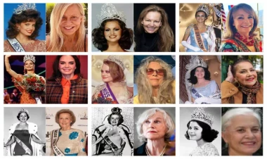 Dünya gözəlləri əvvəl və sonra - FOTOlar