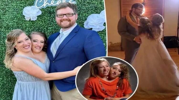 Siam əkizlərinin ikincisi də evlənməyə hazırlaşır