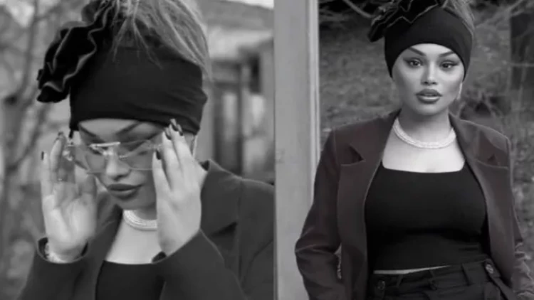 Bu da əməliyyatdan sonra 180 dərəcə dəyişən Türkan - FOTOlar