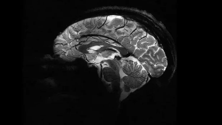 İnsan beyninin ən aydın görüntüsü - FOTO