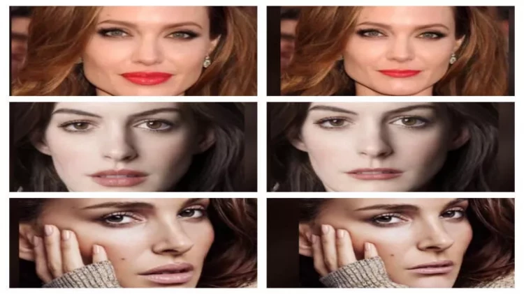 Dodaqlar insanın üzünü necə dəyişir? - Məşhurlar tanınmaz halda - FOTOlar