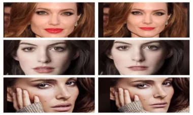 Dodaqlar insanın üzünü necə dəyişir? - Məşhurlar tanınmaz halda - FOTOlar