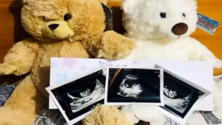 22 gün fərqlə əkiz uşaqlarını dünyaya gətirdi - FOTOlar