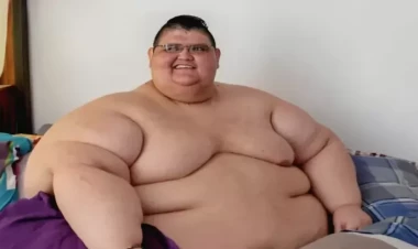 Dünyanın ən kök adamı: Ölümə yaxın rekord - FOTO