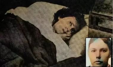 Diş ağrısı ilə yatıb 32 il sonra oyandı - FOTO