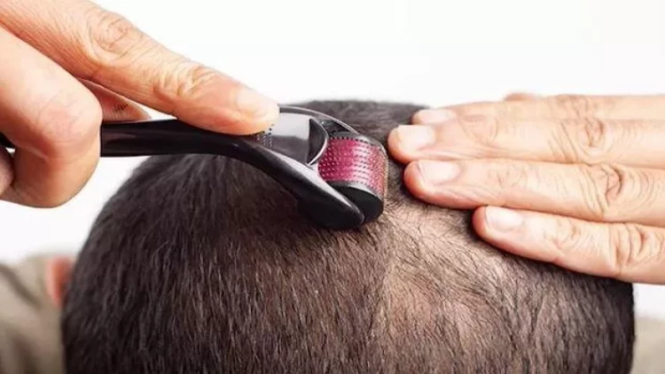 Onlayn satılan saç serumları hansı xəstəliklərə səbəb olur?