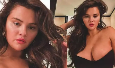 Selena bu şəkilləri paylaşıb, sonra sildi