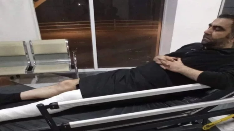 Tanınmış şairi motosiklet vurdu - Ciddi yaralanıb - FOTO