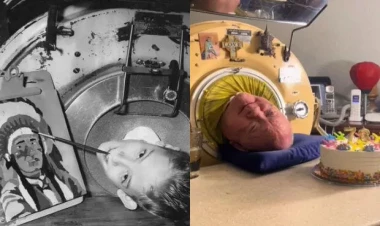 70 il “dəmir ağciyərdə” yaşayan Pol Aleksandr vəfat etdi - FOTOlar