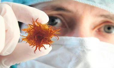 Xərçəngdən öləcəkdi: qeyri-adi müalicədən sonra sağaldı