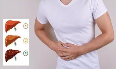 Qaraciyəri piylənmədən necə xilas edək?