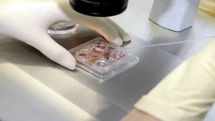 Azərbaycanda süni mayalanma ilə ata olan şəxs illər sonra həyatının şokunu yaşayıb