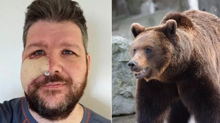 Yanağını dişləyən ayıdan intiqamını belə aldı - FOTOlar