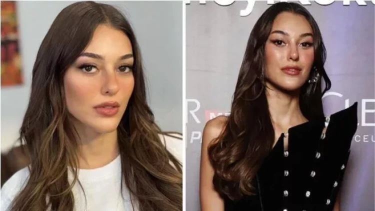 Tanınmış aktrisa plastik əməliyyat qurbanı oldu - FOTOlar