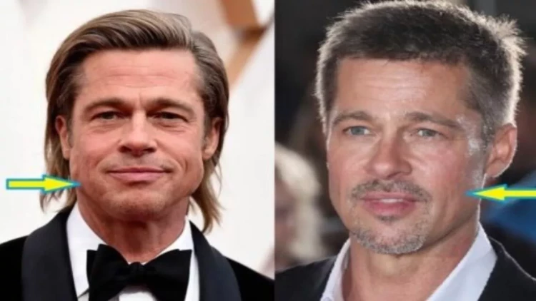60 yaşlı Bred Pitt plastik əməliyyat etdirib? - FOTOlar
