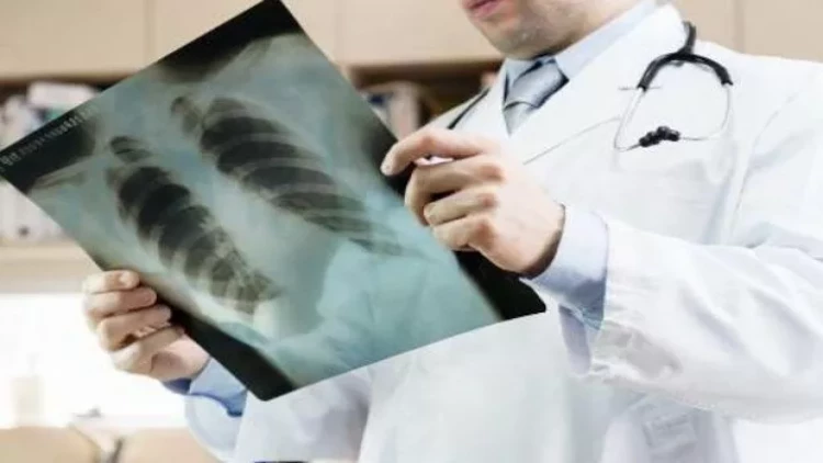 Pakistanda son 10 gündə 42 uşaq öldü - SƏBƏB