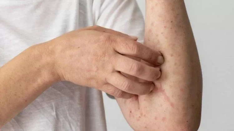 Azərbaycanda 3 xəstəlik tüğyan edir