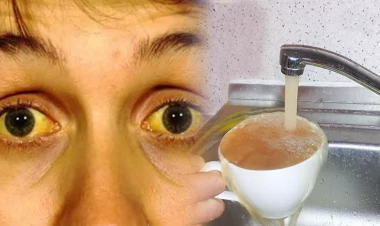 Mingəçevir, Yevlax, ardınca BAKI – Sarılığa yoluxmanın səbəbi ÇİRKLİ SUDUR?