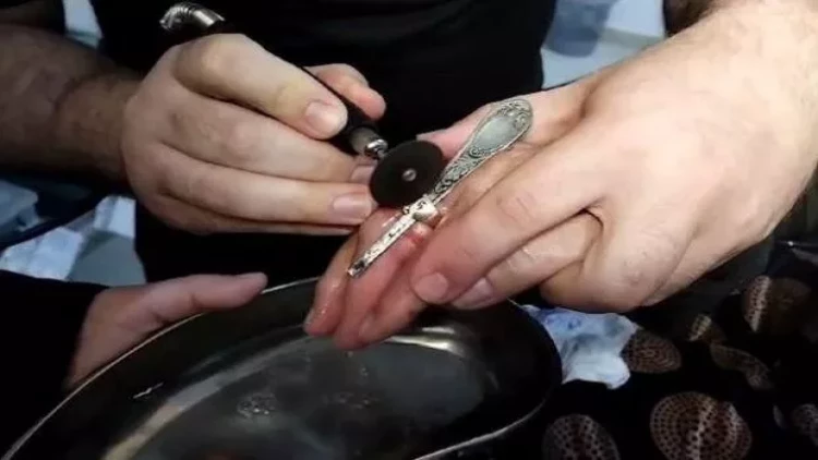 Bakıda barmağına üzük sıxışan yaşlı qadının köməyinə FHN çatdı - VİDEO