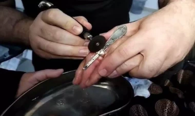 Bakıda barmağına üzük sıxışan yaşlı qadının köməyinə FHN çatdı - VİDEO