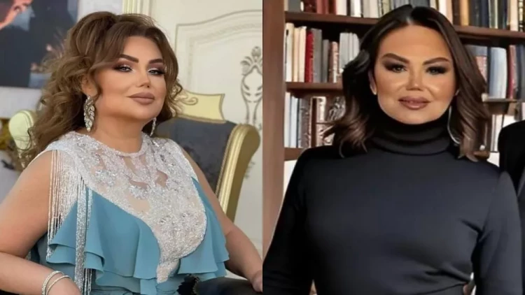 Könül Kərimova özünü tanınmaz hala saldı - FOTO