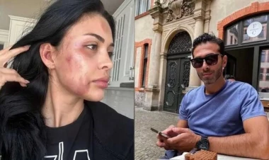 Tanınmış modeli döyməkdə ittiham olunan şəxsin istintaqı tamamlandı