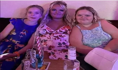 Çox nadir genetik vəziyyət - Köprücük sümüyünün olmadan doğulan qadın - FOTOlar