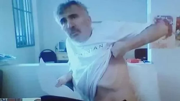 Saakaşvilinin səhhətində mühüm irəliləyiş