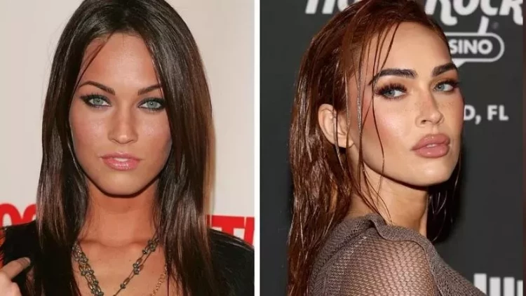 Pulsuz prosedur hədiyyə qazanan qadın həyatı kabusa çevrildi