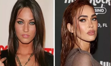 Pulsuz prosedur hədiyyə qazanan qadın həyatı kabusa çevrildi