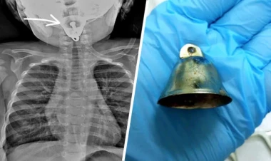 Dəhşətli hadisə: 1 yaşlı uşaq 