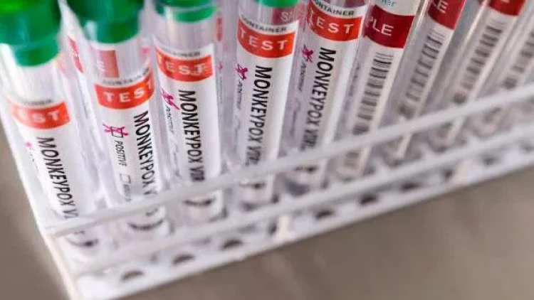 Bu ölkədə “Meymun çiçəyi”ndən ilk ölüm faktı qeydə alındı