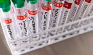 Bu ölkədə “Meymun çiçəyi”ndən ilk ölüm faktı qeydə alındı